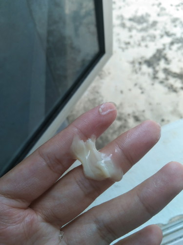 Keputihan pada 28 minggu kehamilan