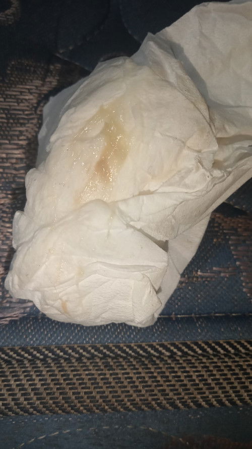 Kputihan seperti lendir agak coklat