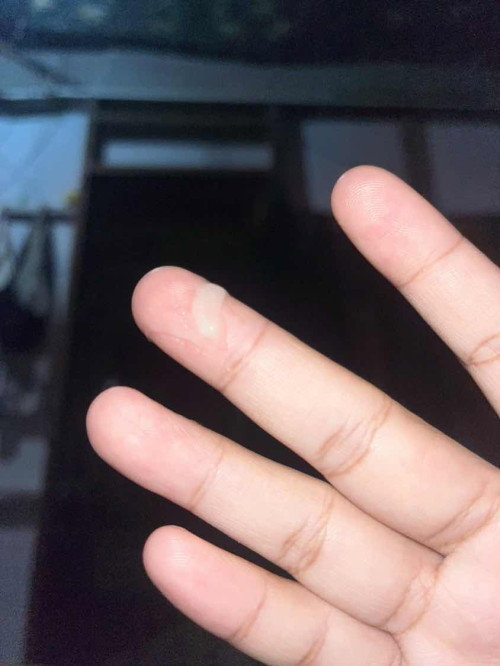 มูกแบบนี้คืออะไรหราค่ะ