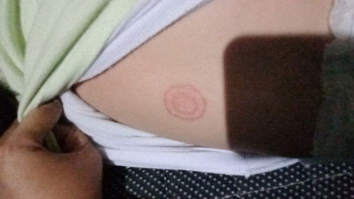 Lingkaran merah di badan