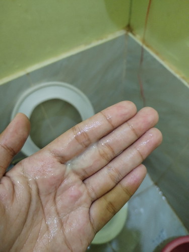 Mucus plug?