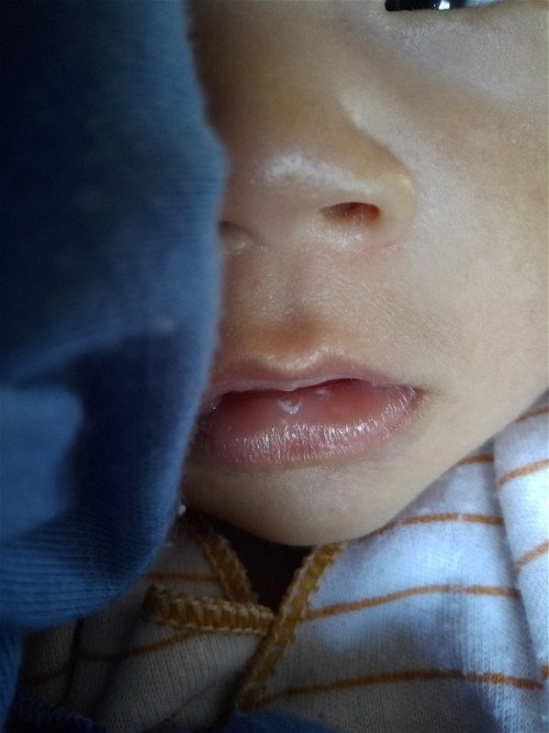 Bibir dalam ada bercak putih