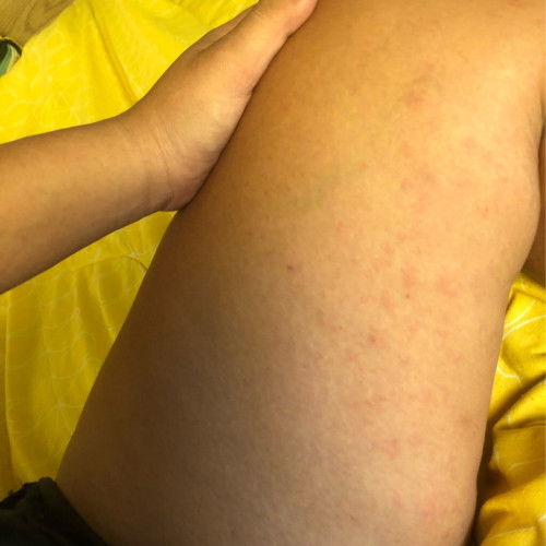 สอบถามค่า อันตรายมั้ยคะ