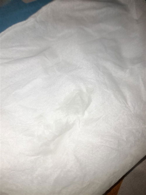 Air ketuban rembes atau keputihan ya?