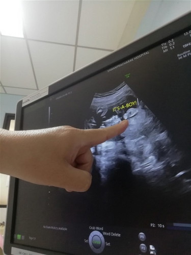 ตอนนี้ตั้งครรภ์ได้24week5day แล้วค่ะ เท่ากับกี่เดือนคะ... แล้วแม่ๆซื้อของเตรียมคลอดกันตอนไหนคะ....