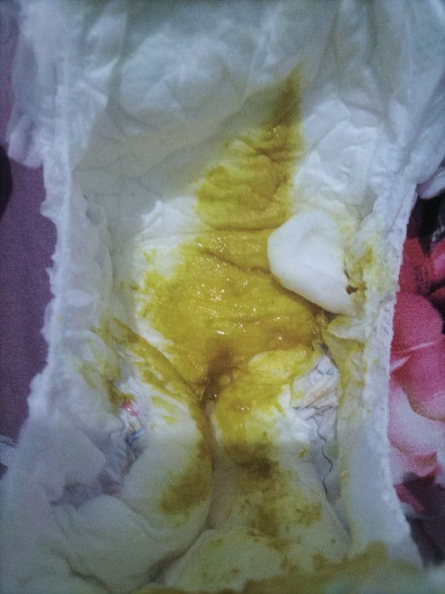 Bab bayi 2 bulan berlendir