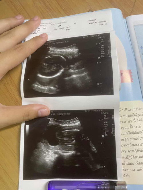 มีใครพอดูออกไหมคืออะไรเราดูไม่ออกดูออก