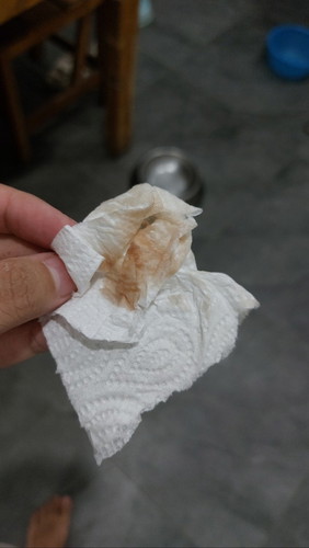 อายุครรภ์ 4w มีน้ำๆแบบนี้ออกมา ปกติไหมคะ