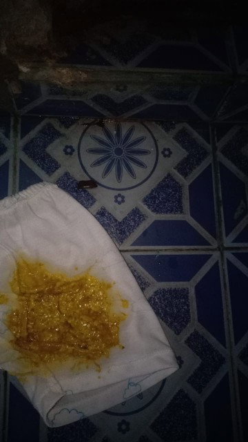 Pencernaan anak