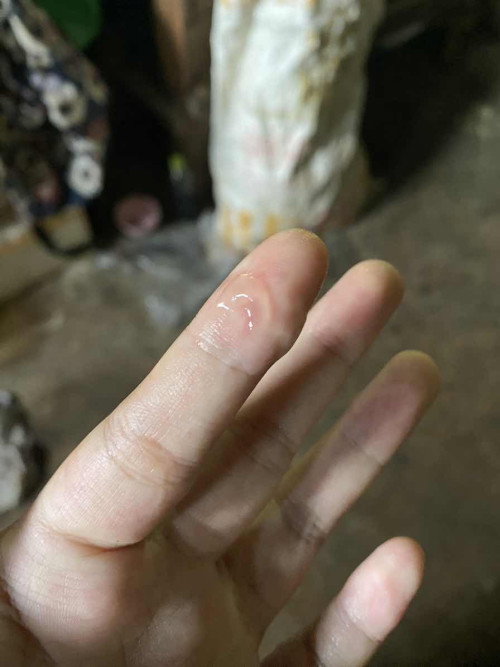 มีมูกใสควรไปหาหมอตอนนี้เลยมั้ยคะ