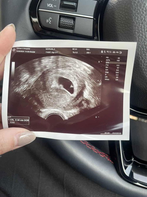 เมื่อคุณหมอคอนเฟิร์มว่าทารกหยุดการเจริญเติบโต