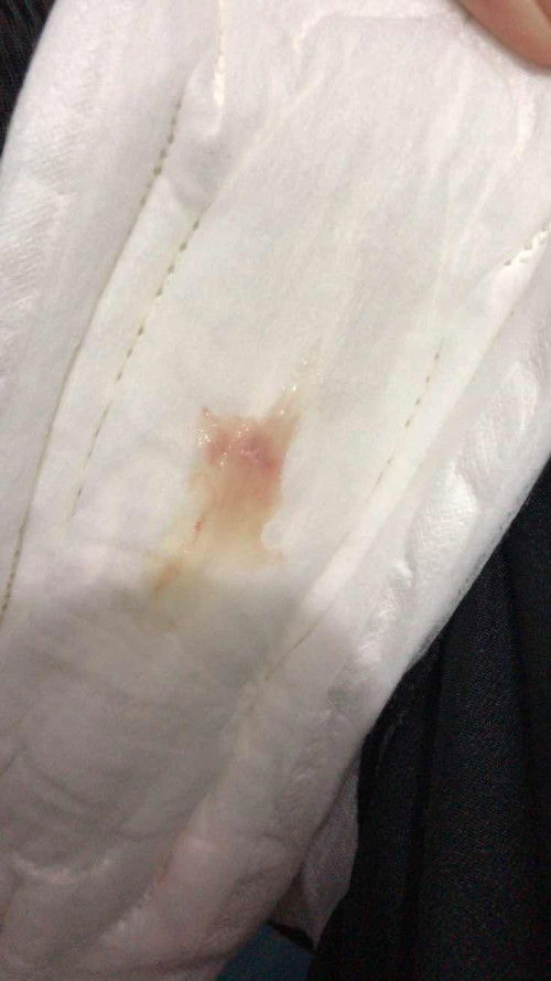 Keluar flek di usia 36 week