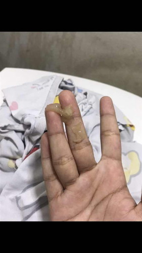 มีมูกออกอะค่ะไม่หมดสักทีแต่ไม่มีเลือดน่ะค่ะ