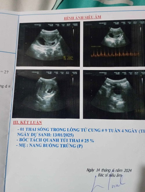 Vợ em mang thai 10 tuần bị bóc tách 25% , nhưng bé vẫn khoẻ bình thường , thì có nguy hiểm k ạ