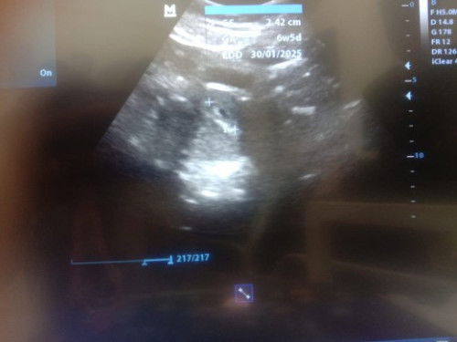 Dimana letak rahim ku ?