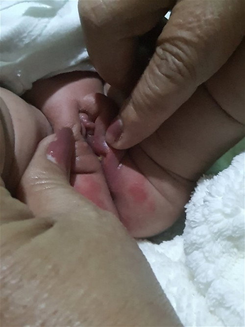 Pa help naman po parang may butas po sa pepe nia b🥹😭