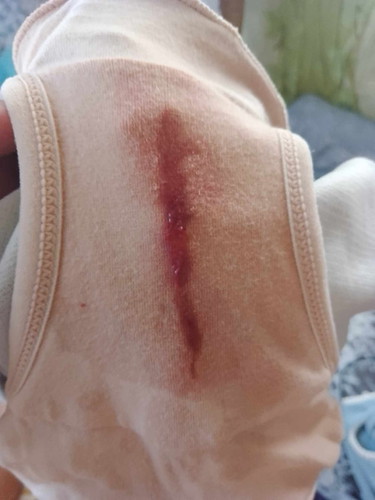 NSFW: Matanong lang po, bloody show or mucus plug na po ba to? Malapit na po ba akong manganak nito?