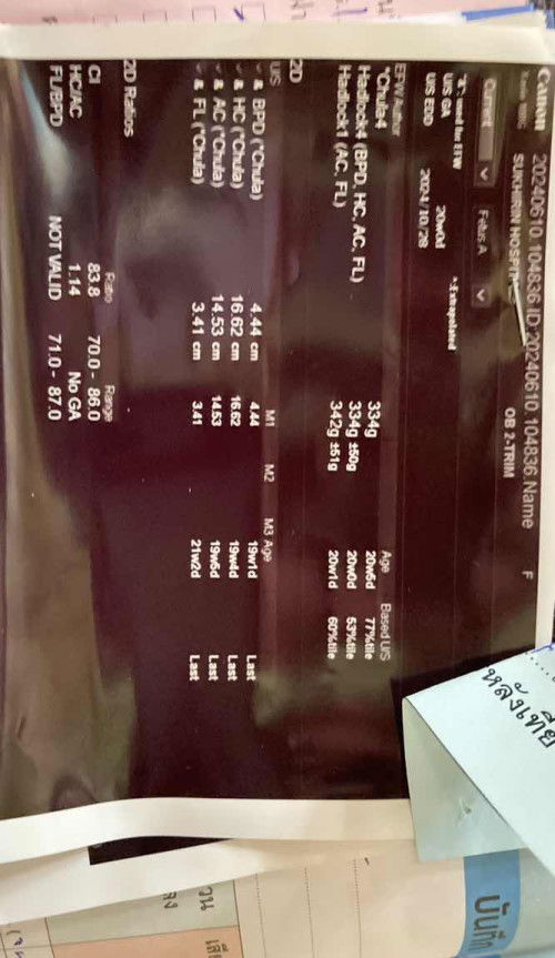 ผลตรวจอะไรเหรอคะ หมอตรวจแล้วบอกเพศลูกแต่แม่ฟังที่หมอบอกไม่ทัน