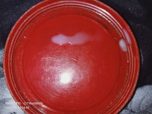 HPL 21 juni
39 minggu 1 hari blm kontraksi