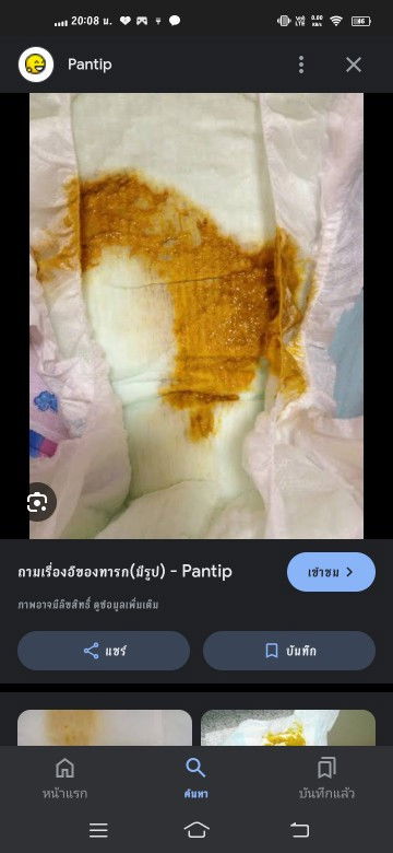 สอบถามค่ะ เด็กอายุ 7 เดือน เรื่องระบบขับถ่าย