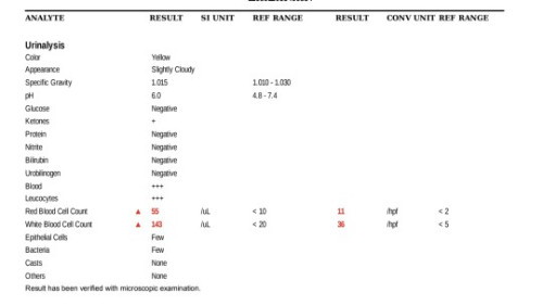 URINALYSIS