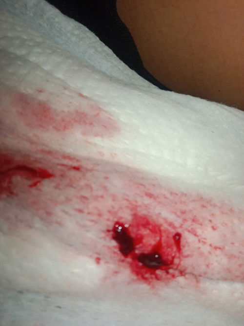 First time ko mag delay nang 1 month