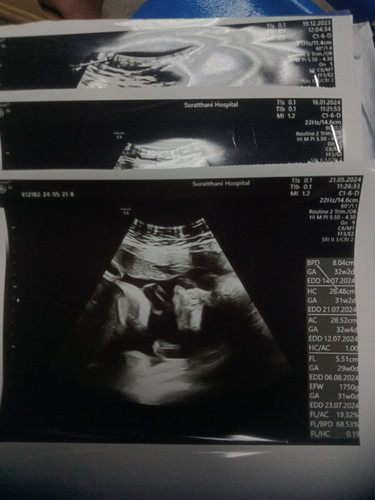 36week ท้องเเรก