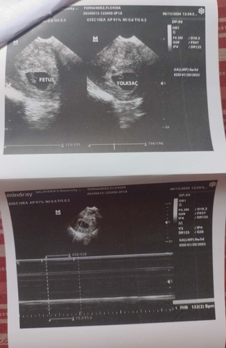 Makikita n b agad ang gender if nasa 8week pa lang c baby..? Naka pag tvs nmn n aq..active nmn sya..