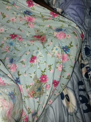 Hamil 11 minggu pas bangun tdur subuh keluar air kyak gitu.jadi takut 😢Ada yg kyak gitu nggak kak.