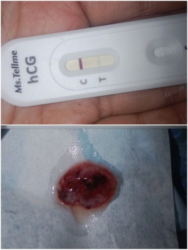 Pendapat..