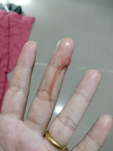 มีมูกเลือดออกตอนเช้า อายุครรภ์ 29Week