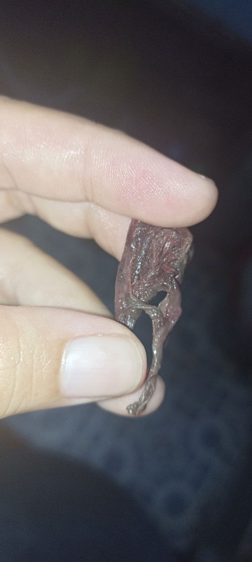 Gumpalan darah seperti ini saat haid pertama apakah normal?