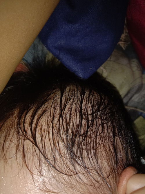 Kepala bayi berkeringat