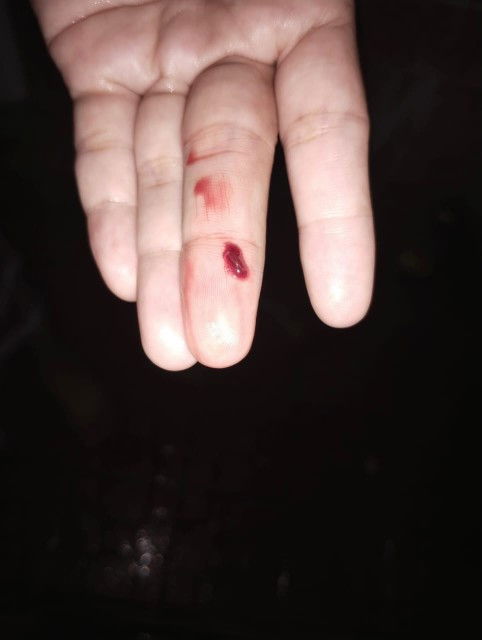 Kehamilan 18minggu kluar darah dan gumpalan.