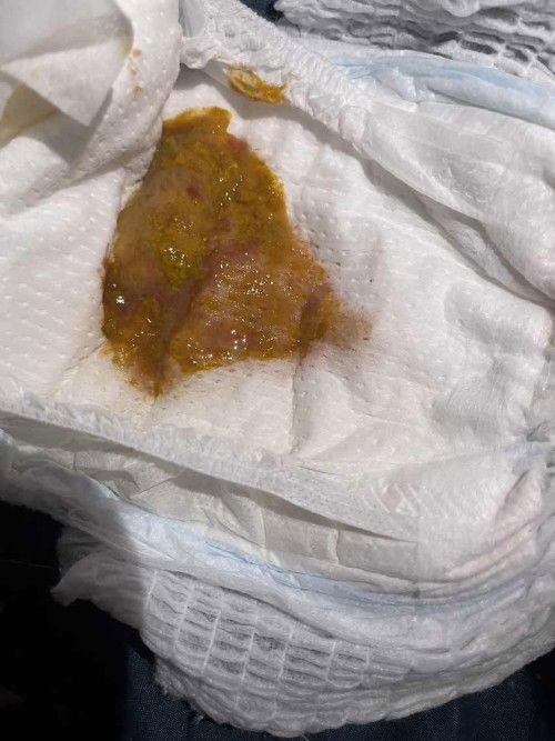 แบบนี้ปกติไหมค่ะ