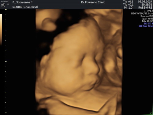 สาวน้อยได้กลับมาอีกครั้ง