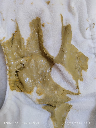 poop color pls help confirm if it's still normal