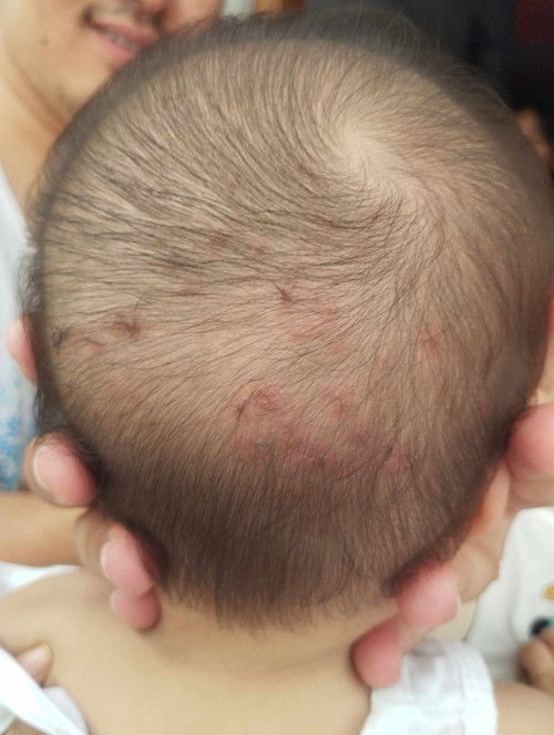 Hello po anu po kaya ito ? Thanks po