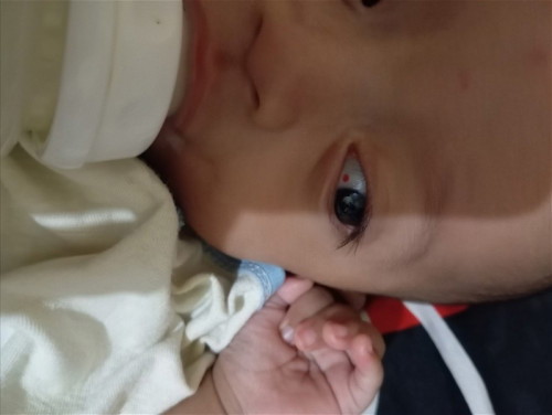 Ada yang pernah mata bayi bintik merah kayak gini gak ya baru saja kejadianny. Gimana solusinya bunn