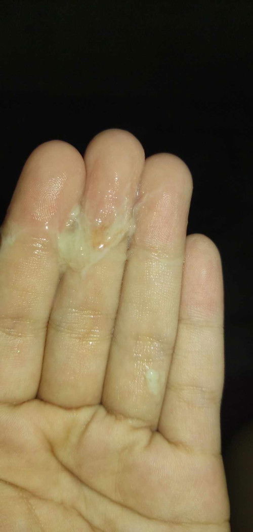 MUCUS PLUG OR NOT? 39W and 6 Days