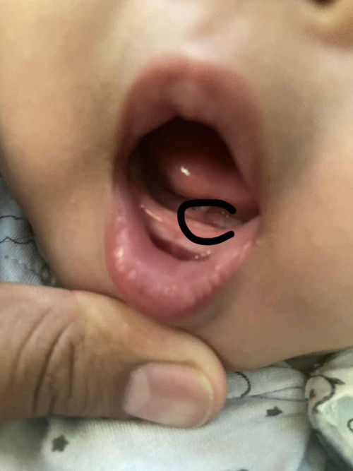 ลูกชาย3เดือน5วัน