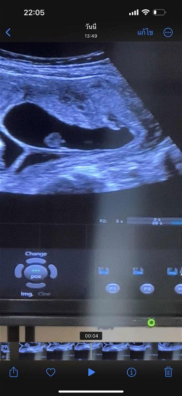 ช่วยดูรูปซาวด์หน่อยค่ะ