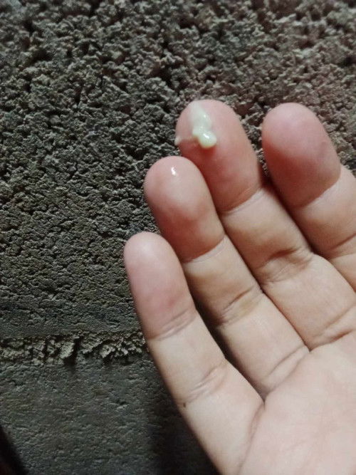 ขอสอบถาม เเม่ๆหน่อยค่ะ มีใครเป็นตกขาวเยอะบาง