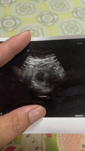 กังวลมากเลยค่ะ