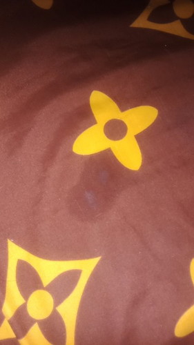 มีน้ำใสๆไหลออกจากช่องคลอด นิดหน่อยควรไปหาหมอไหมค่ะ ไม่เคยเป็นแบบนี้เลย 34+1