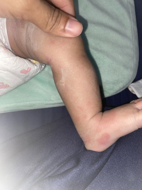 ผืนเเดงขึ้น