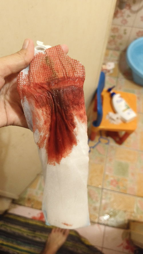 แบบนี้เรียกตกเลือดไหม