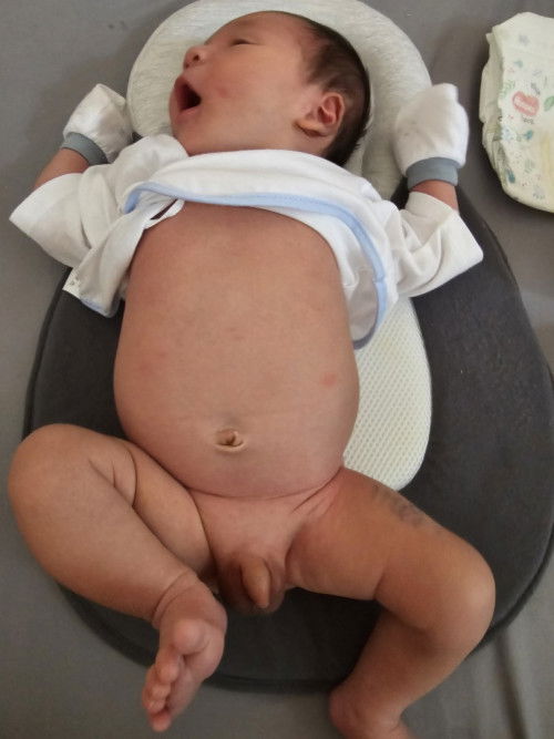 E bé 15 ngày tủi ăn 1 bữa 120ml có nhiều quá k các mom ơi