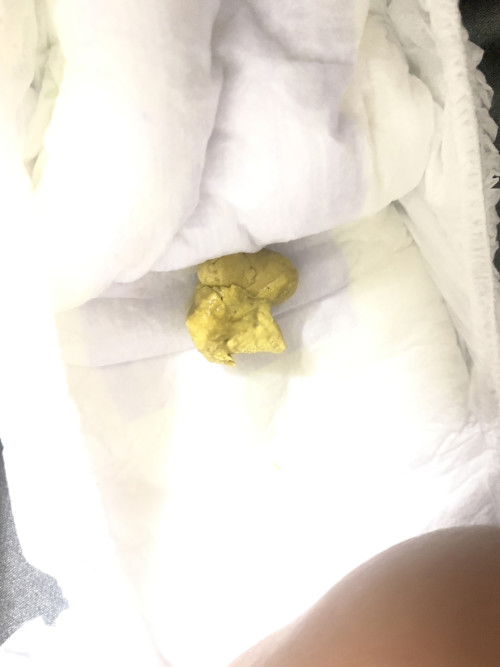 normal ke najis 3 bulan macamni ?