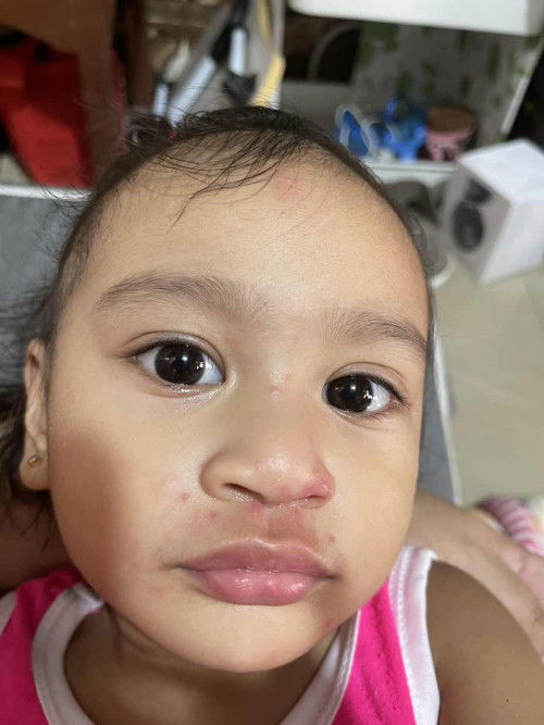 ask ko  lang po sana kung mamaso ang ganito